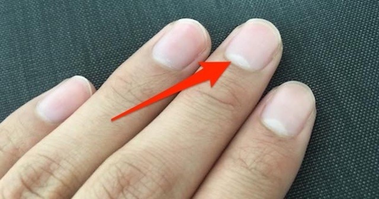 私の月粒が小さい、または欠けている場合、それは何を意味しますか?